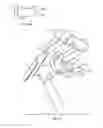 Fig. 05 - Surgical instrument system and method for providing retraction and vertebral distraction