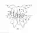 Fig. 06 - Surgical instrument system and method for providing retraction and vertebral distraction
