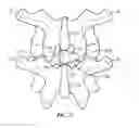 Fig. 09 - Surgical instrument system and method for providing retraction and vertebral distraction