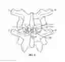 Fig. 10 - Surgical instrument system and method for providing retraction and vertebral distraction