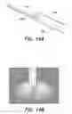 Fig. 16 - Endoscopic polarized multispectral light scattering scanning method