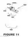 Fig. 12 - Method and apparatus for aligning antennas of low-powered intra- and extra-oral electronic wireless devices