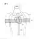 Fig. 04 - METHOD FOR CONTRAST AGENT-FREE MAGNETIC RESONANCE COLONOGRAPHY