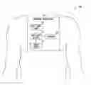 Fig. 01 - Method and apparatus for detecting atrial filling pressure