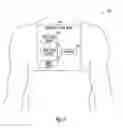 Fig. 10 - Method and apparatus for detecting atrial filling pressure