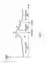 Fig. 05 - Method and apparatus for management of heart failure hospitalization