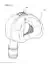 Fig. 10 - ADAPTABLE BREATHING MASK