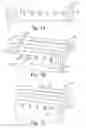 Fig. 02 - Methods of making hollow microneedle arrays and articles and uses therefrom