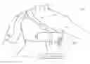 Fig. 01 - Shoulder stabilizing orthotic