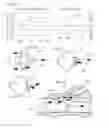 Fig. 06 - Methods, Systems and Devices for Desufflating a Lung Area