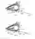 Fig. 02 - Retrobulbar syringe including soft cannula distal end