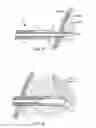 Fig. 04 - Retrobulbar syringe including soft cannula distal end