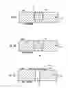 Fig. 12 - Method and apparatus for detecting occlusions in an ambulatory infusion pump