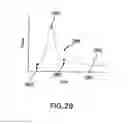 Fig. 30 - Method and apparatus for detecting occlusions in an ambulatory infusion pump