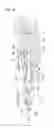 Fig. 08 - Needle unit and dermatological liquid injection apparatus using the same