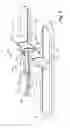 Fig. 03 - Catheter anchoring system, apparatus and method