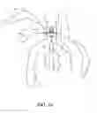 Fig. 30 - Catheter anchoring system, apparatus and method