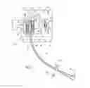Fig. 03 - CATHETER ANCHORING SYSTEM