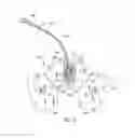 Fig. 05 - CATHETER ANCHORING SYSTEM