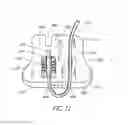 Fig. 10 - CATHETER ANCHORING SYSTEM