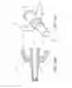 Fig. 31 - Medical connector