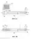 Fig. 03 - Intraluminal cannula placement apparatus utilizing a specialized cannula for use with a previously inserted I.V. catheter