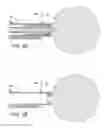 Fig. 04 - Apparatus and Method for Capsule Formation in Tissue