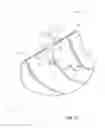 Fig. 14 - Bodily fluid drainage assembly