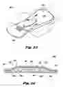 Fig. 11 - ABSORBENT ARTICLE INCLUDING A FORMED FIBROUS ARTICLE
