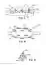 Fig. 04 - Biodegradable protrusions on inflatable device