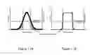 Fig. 11 - LASER SELECTIVE CUTTING BY IMPULSIVE HEAT DEPOSITION IN THE IR WAVELENGTH RANGE FOR DIRECT-DRIVE ABLATION