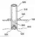 Fig. 01 - Method and apparatus for tissue grafting