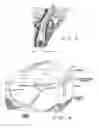 Fig. 04 - Method and apparatus for treating subcutaneous histological features