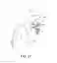 Fig. 34 - Tissue ablation methods