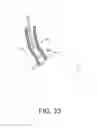 Fig. 40 - Tissue ablation methods