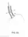 Fig. 40 - Tissue ablation systems