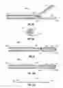 Fig. 05 - Surgical forceps including shape memory cutter