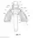 Fig. 06 - INTRA-ORAL STABILISATION DEVICE