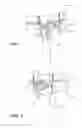 Fig. 08 - INTRA-ORAL STABILISATION DEVICE