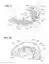 Fig. 09 - INTRA-ORAL STABILISATION DEVICE