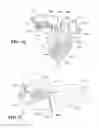 Fig. 12 - INTRA-ORAL STABILISATION DEVICE