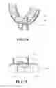 Fig. 16 - INTRA-ORAL STABILISATION DEVICE