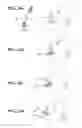 Fig. 17 - INTRA-ORAL STABILISATION DEVICE