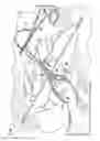 Fig. 02 - CABLE TIE SYSTEM FOR STABILIZING BONE