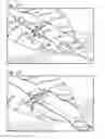 Fig. 06 - CABLE TIE SYSTEM FOR STABILIZING BONE