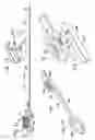 Fig. 07 - CABLE TIE SYSTEM FOR STABILIZING BONE