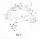 Fig. 05 - Customized patient-specific acetabular orthopaedic surgical instrument and method of use and fabrication