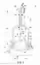 Fig. 07 - Customized patient-specific acetabular orthopaedic surgical instrument and method of use and fabrication