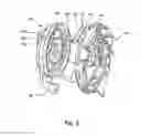 Fig. 05 - Hybrid epilator device