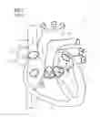 Fig. 02 - Fastening Device for a Mitral Valve and Method
